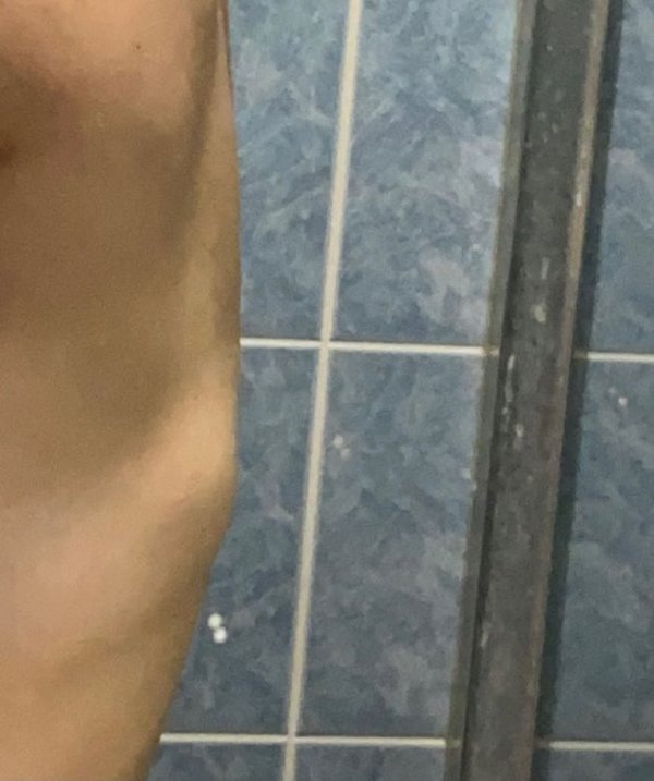 她在9月初感到背部痠痛，發現骨頭凸起，最終確診骨癌。（圖片來源：妙妙貓小公主@caiping_apple）