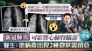 超過三分一的重症新冠肺炎患者有肺部纖維化等永久性損害出現。