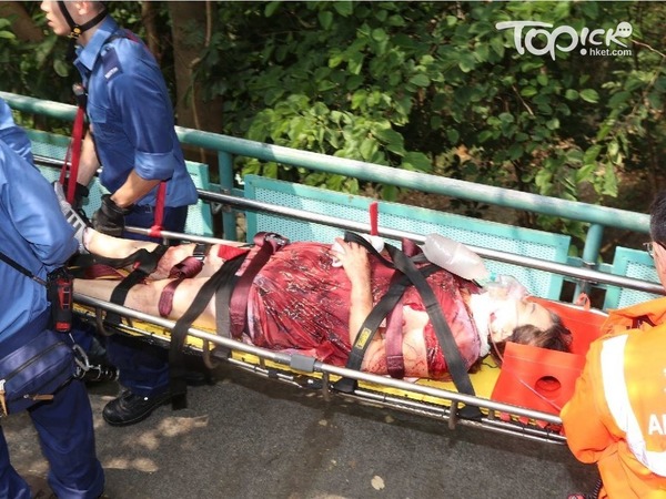 其中一名傷者腹部中刀。（曾秋文攝）