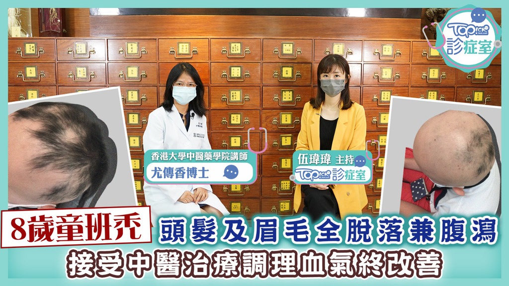 【TOPick診症室】8歲童班禿頭髮及眉毛全脫落兼腹瀉 接受中醫治療調理血氣終改善