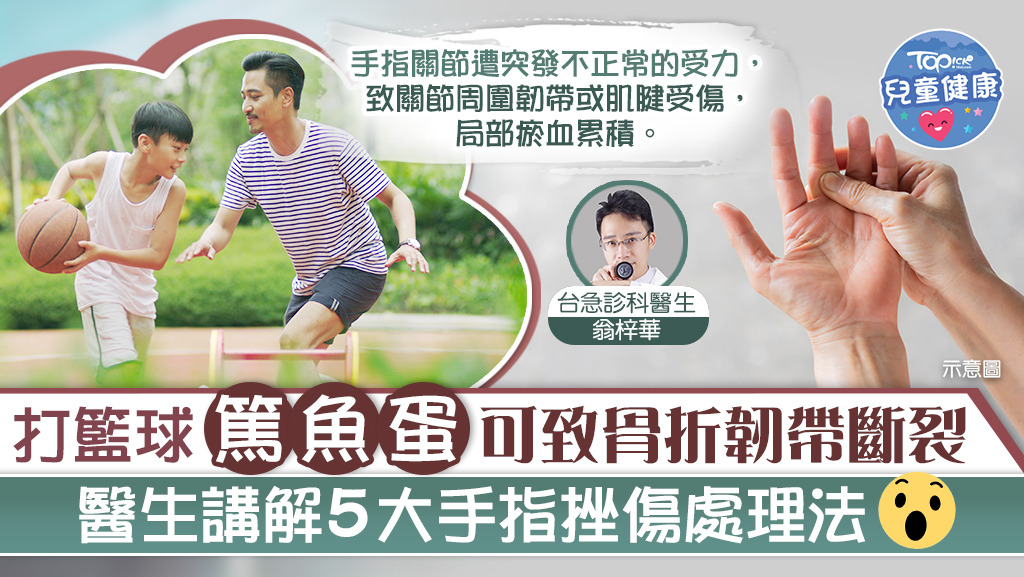 打籃球 小朋友 篤魚蛋 可致骨折韌帶斷裂醫生講解5步驟處理手指挫傷 香港經濟日報 Topick 親子 兒童健康 D2913