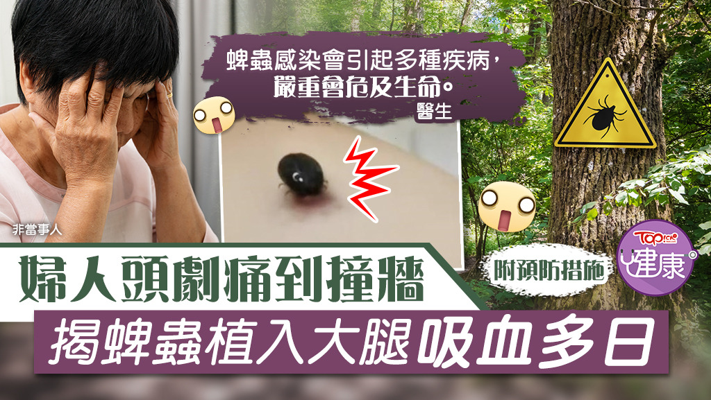 婦人頭劇痛到撞牆，揭蜱蟲植入大腿吸血多日。