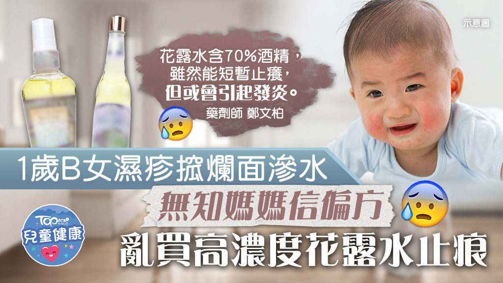 有台灣媽媽信偏方，想買花露水給1歲B女治濕疹。