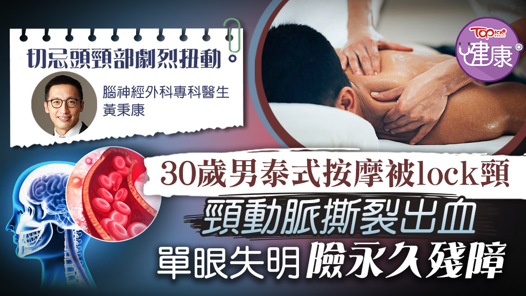 30歲男泰式按摩被lock頸，頸動脈撕裂出血導致單眼失明，險永久殘障。