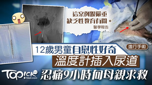 中國一名12歲男童自慰性好奇，將溫度計插入自己尿道。