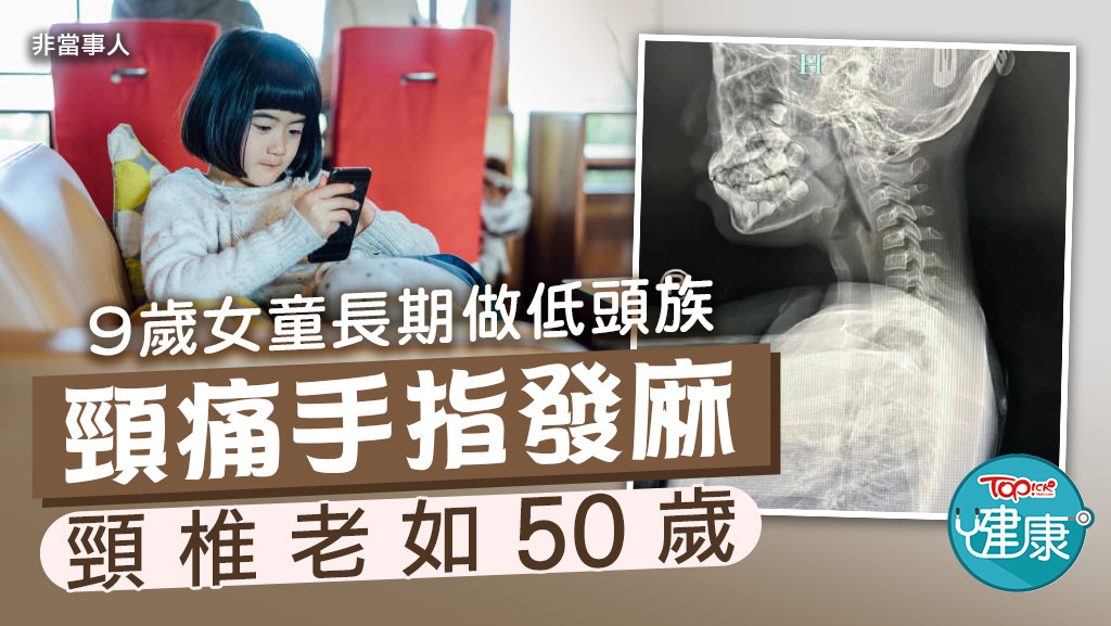9歲女童長期做低頭族，頸痛手指發麻，頸椎竟老如50歲。