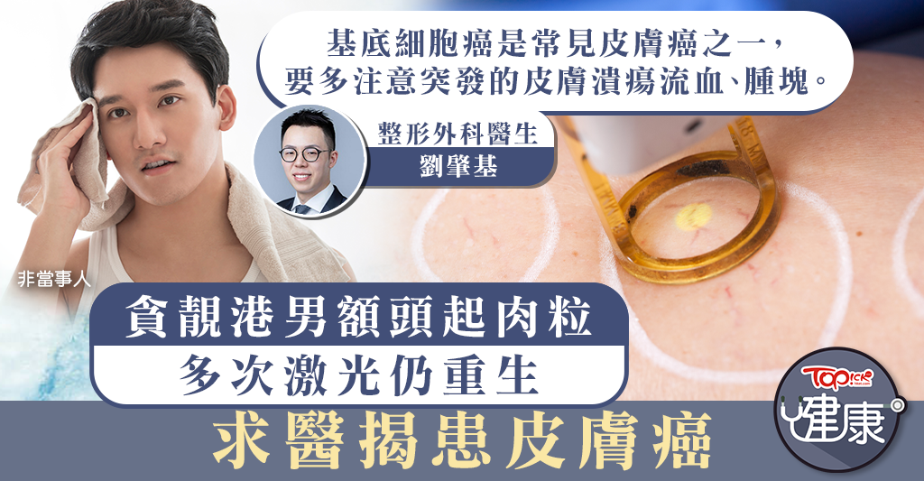 [Skin cancer]Greedy and beautiful Hong Kong man with flesh granules on his forehead multiple times laser still reborn and seeks doctor to reveal skin cancer[with symptoms]- Hong Kong Economic Daily – TOPick – Health – Doctor’s Consultation Room