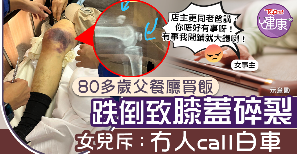 [Elderly Falls]Over 80-year-old father fell in a restaurant and broke his knee, daughter reprimanded: No one called the white car – Hong Kong Economic Daily – TOPick – Health – Health Information