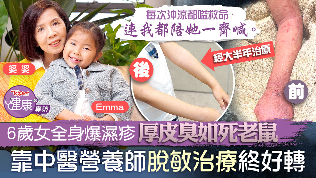 父母平日要工作，Emma主要是由婆婆照顧，故非常痛心外孫女患病。