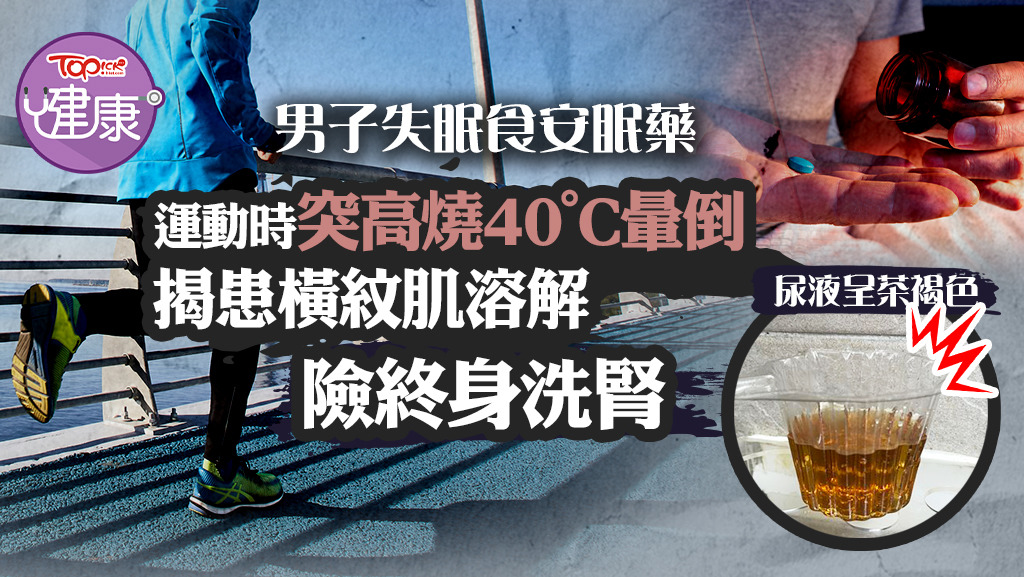 男子失眠食安眠藥，運動時突高燒40°C暈倒，揭患橫紋肌溶解險終身洗腎。