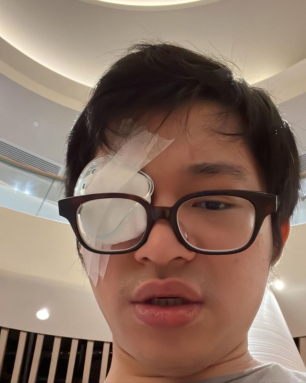 林作以後不可再打拳。