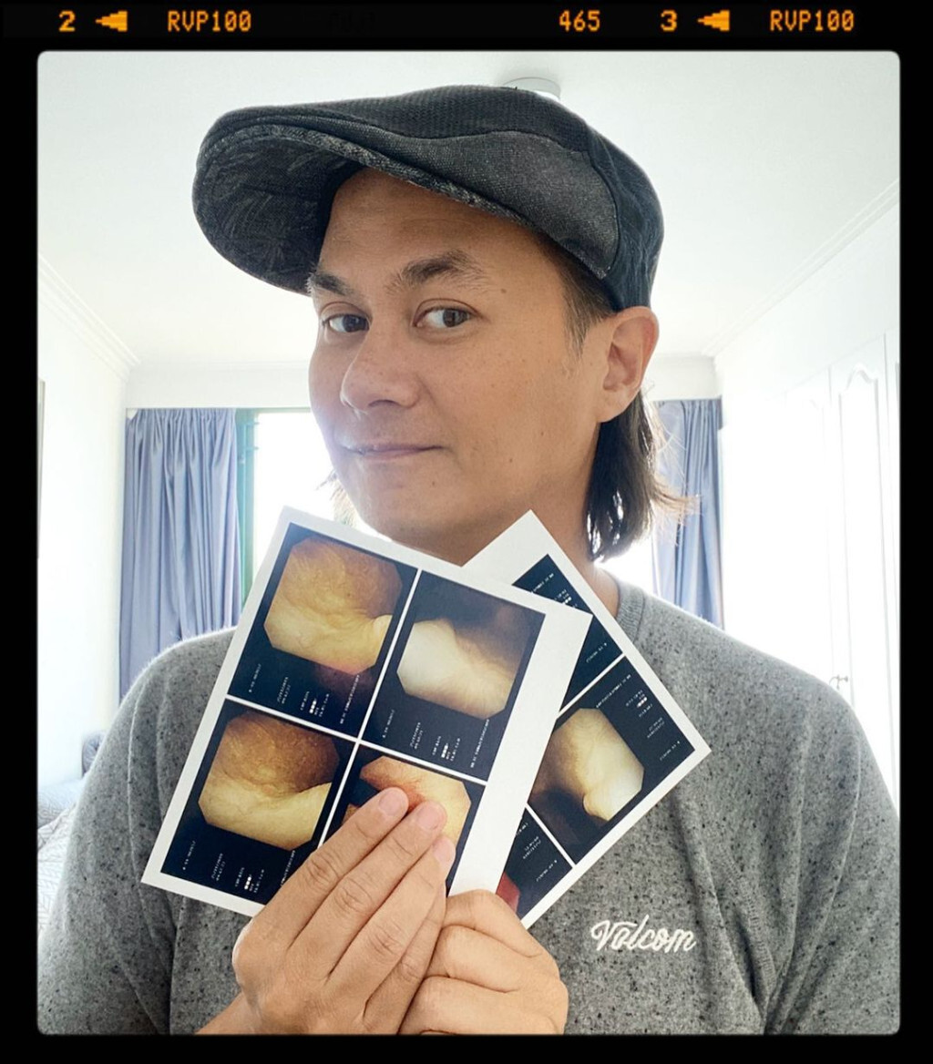 許懷欣早年確診癌症。（取自instagram）