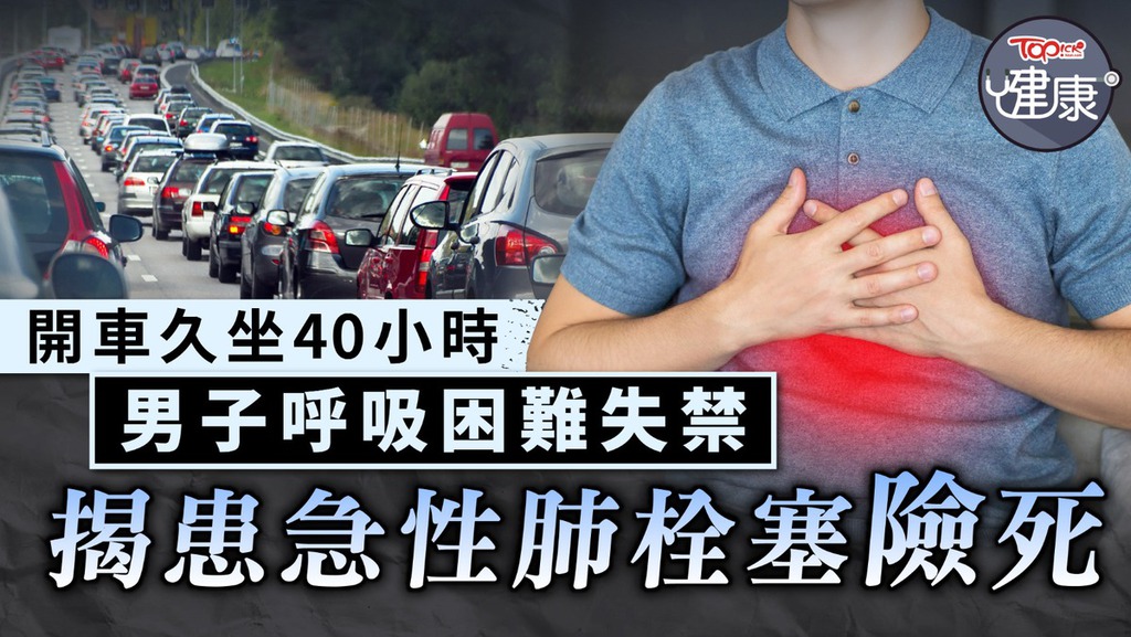 男子開車久坐40小時呼吸困難失禁，揭患急性肺栓塞險死！