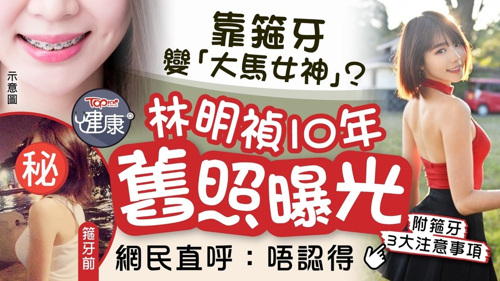 林明禎 大馬女神｜靠箍牙變「大馬女神」？林明禎10年前舊照曝光網民直呼：唔認得