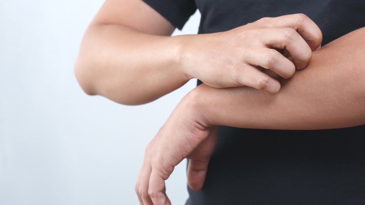 The Itchy Truth How a 3Month Skin Rash Led to a Shocking Liver Cancer