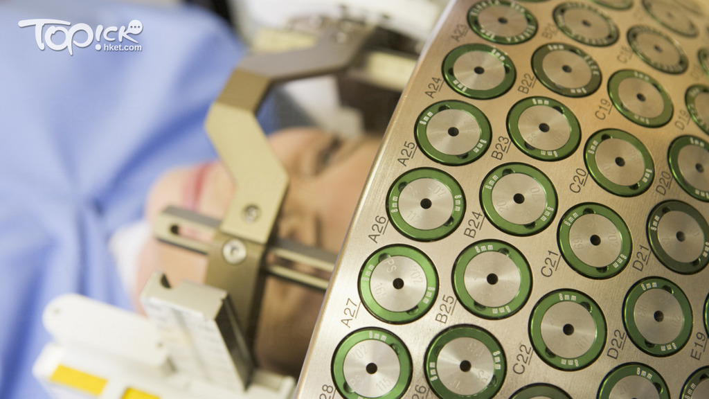 伽瑪刀（Gamma Knife）。　（相片來源：iStock）