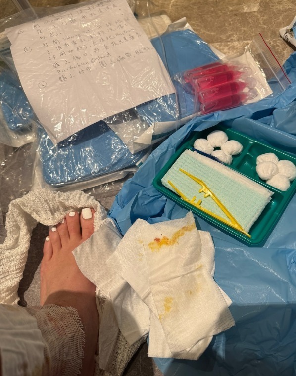 梁齊昕3月4日曾上載自己腳部包紮照片。