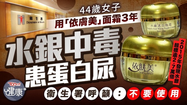 44歲女子用「依膚美」面霜3年水銀中毒患蛋白尿　衞生署呼籲：不要使用