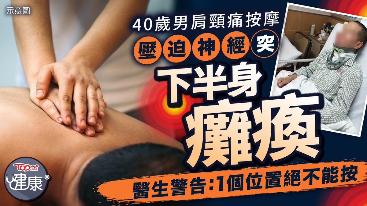 按摩風險｜40歲男肩頸痛按摩壓迫神經突下半身癱瘓醫生警告：1個位置絕不能按