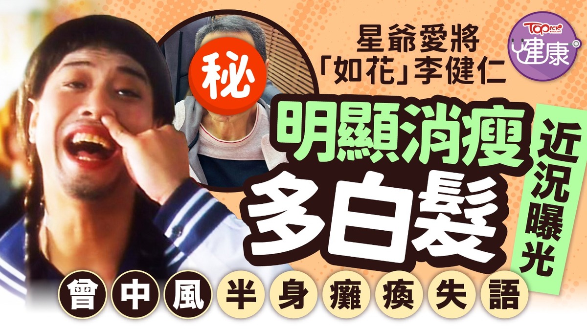 明星近況|星爺愛將「如花」李健仁 明顯消瘦多白髮近況曝光 曾中風半身癱瘓失語