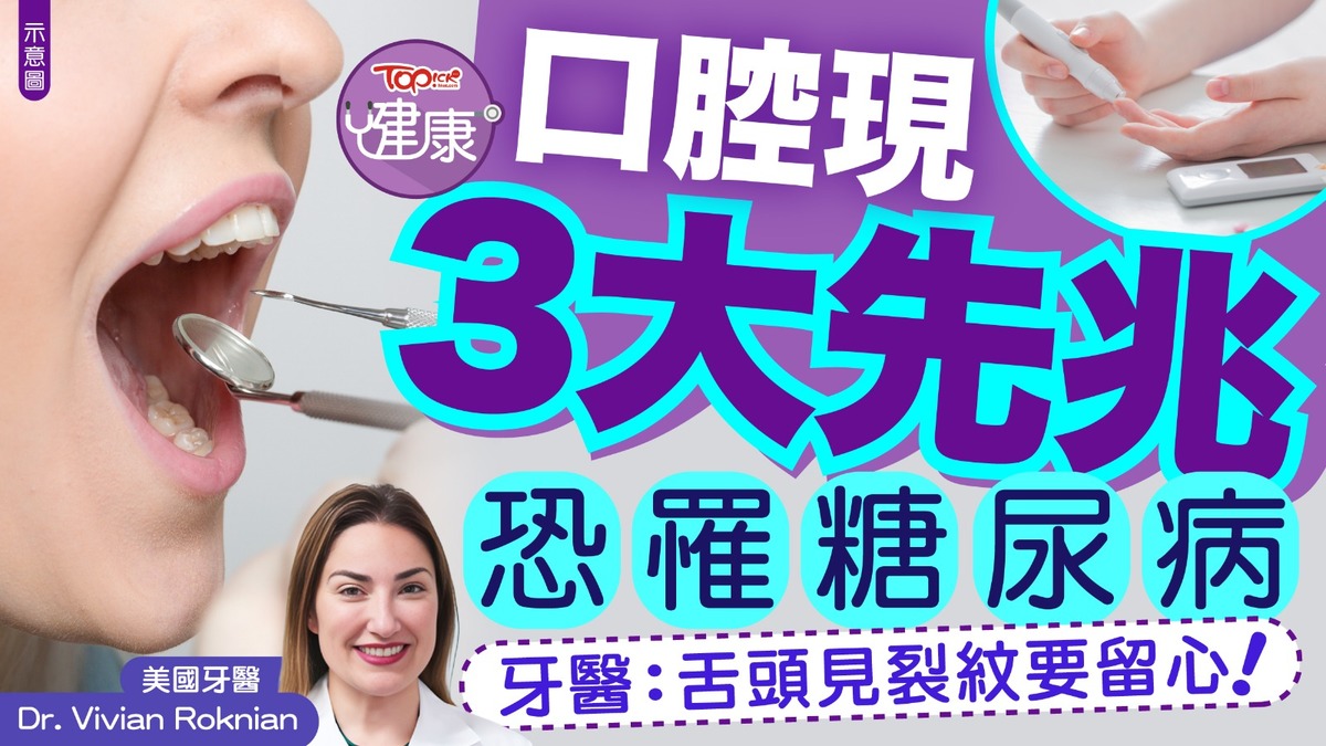 圖檔